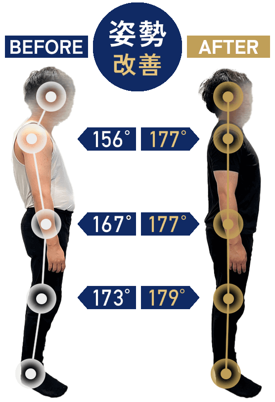 姿勢改善